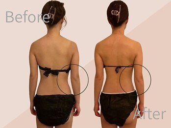 ファミーユ 名古屋店/【首肩、ブライダルケア】