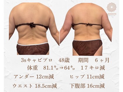 モミン(MOMI.N)の写真
