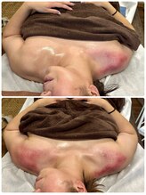 スピード美人 本八幡店/巻き肩剥がしで華奢感GET