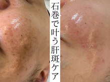 セレニア ボーテ(Selenia Beaute)