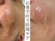 セレニア ボーテ(Selenia Beaute)の写真