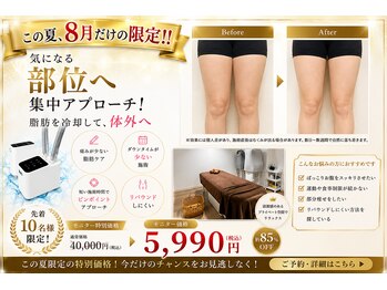 カイビサロン 武蔵小杉(KAIBI SALON)の写真/【8月だけ限定!!】モニター5,900円!!最新AIで脂肪冷却痩身/最大出力ー12°Cで冷却/安心の都度払い♪