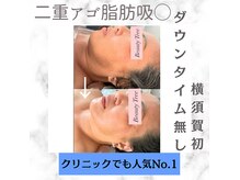 ビューティーツリー(Beauty Tree)の雰囲気(痛みほぼ無し!最新のリップケア^^血色の悪さお悩みの方に)