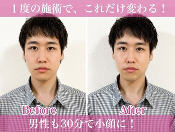 小顔美肌痩身エステ 希美熟 -NOZOMIJUKU- 【東京銀座店】の写真/【男性歓迎♪】本格施術で男性も小顔&ボディメイク! 30分の施術で効果を実感してください!
