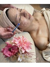 サナティオ(SANATIO)/陶器肌♪針を使わない