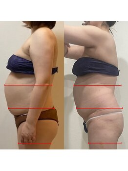 シュエットプラス(Chouette+)/遠赤マットで汗かきながら!