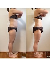 ブルーム(BLOOM)/3ヶ月痩身プログラム