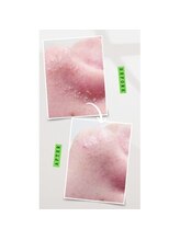 ラグラン銀座メディカルエステ 高輪ゲートウェイ店/【FACE】セルマジ・ビフォアフ