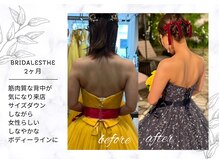 アモリール(Amolir)/ブライダル痩身ビフォーアフター