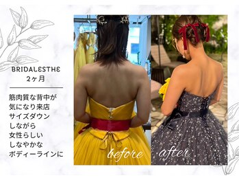 アモリール(Amolir)/ブライダル痩身ビフォーアフター