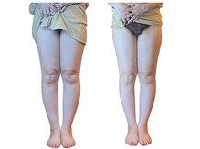 ベンザイ 新潟店(BENZAI)/冷えむくみ脚パンパン