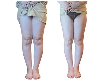 ベンザイ 新潟店(BENZAI)/冷えむくみ脚パンパン