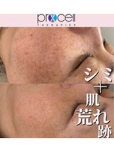 クレア(crea)/お肌【プロセルセラピーズ】金山