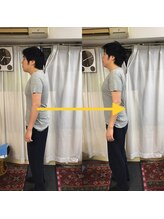 新橋整体グッドラックカイロプラクティック(Good Luck)/顎が出る猫背姿勢を何とかしたい