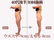 ベモーレ 谷町九丁目 上本町/40代後半/10回施術