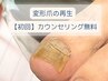 【変形爪の再生】カウンセリング無料☆初回1趾16500円