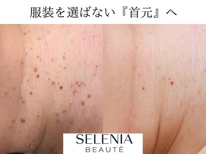 セレニア ボーテ(Selenia Beaute)の写真