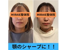 広島ミライエ整体院(広島MIRAIE整体院)の雰囲気（美容鍼で顎がシャープ＆リフトアップ【広島市/十日市/美容】）