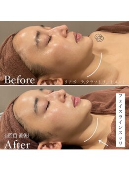 ミエル 神戸店(Miel)/リアボーテタラソトリートメント