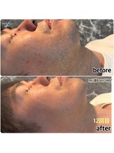 シンバ 倉敷店(SIMBA)/