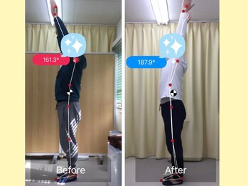 ナオル整体 春日部院(NAORU整体)/春日部/整体/姿勢矯正/猫背矯正