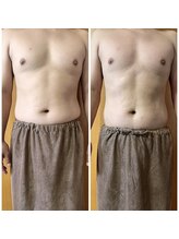 ヒーリングリゾート ナゴミ(Nagomi)/【電磁パルス】