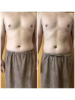 ヒーリングリゾート ナゴミ(Nagomi)/【電磁パルス】