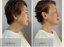 ウィッシュプロサロンケー(Wishpro salon K)の雰囲気（ 1回の効果です！首は主にインディバでお顔はウイッシュプロ！）