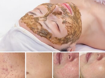 ドクターマジックタッチ(Dr.MAGIC TOUCH)の写真/【諦めていた肌悩みに終止符を◎】乾燥による化粧崩れお肌の土台を変えてすっぴん艶肌の演出を叶えます☆