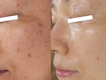 ルミナ シブヤ(LUMINA SHIBUYA)/【ダクトピール】５回目