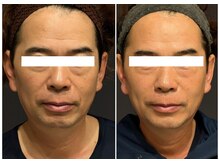 トリニティスペース(TrinitySpace)/レモンボトルビフォーアフター