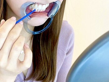 エクシアホワイトニング 碧南店の写真/最新機器使用で当店人気☆蓄積された汚れはコスパ抜群のエクシアで白い歯に！ブライダル前にもオススメ◎