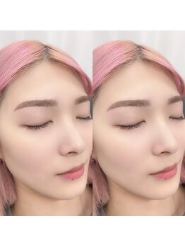 ルミシアトウキョウ 福岡博多駅前店(LUMICIA. TOKYO)の写真/【つるすべ美肌&美眉を同時にGET】 第一印象UPの秘訣★フェイシャルWAX+美眉毛アイブロウWAXで透明感爆上げ