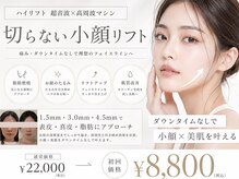 ソラ(Sola)