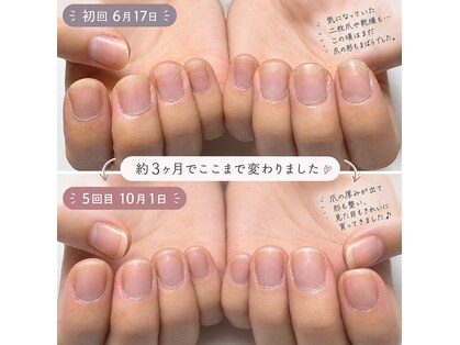 アティックネイルアトリエ(attic nail atelier)の写真