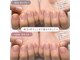 アティックネイルアトリエ(attic nail atelier)の写真