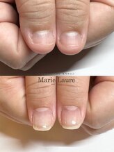 マリーロール 梅田店(Marie Laure)/自爪育成/深爪矯正/ネイルケア