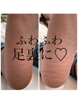 シャトン(Chaton)/