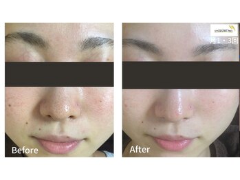 レガート(Legato)/肌質改善/韓国女優アイドル肌へ