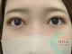 ノア(noa)の写真/リピート続出中！自まつげの状態を見極め、お客様一人一人の目元に合った施術をご提案☆モチの良さ定評有！