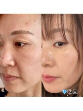 アバンギャルド(Avantgarde)/