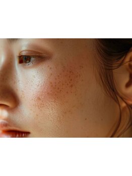 シミしわ改善！予防ケア