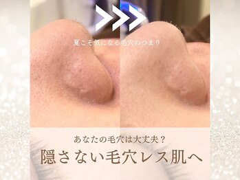 まつげ屋リュ( Ly)/ハイドラフェイシャル