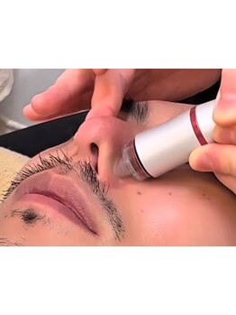 メンズフェイシャル