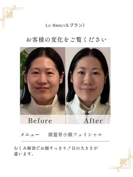 ルブラン(Le Blanc)/before after のお写真
