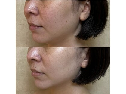 リフテグレース(LIFTE Grace)の写真