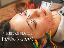 潤(URUOI)の雰囲気（【男性にも大人気！】内側からお顔を整える美容鍼◎）