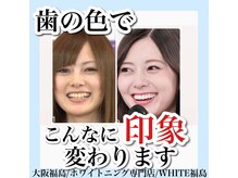 ホワイトニングサロン ホワイト(WHITE)/セルフホワイトニング/大阪/福島