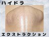 ハイドロ毛穴洗浄×毛穴エクストラクション☆水光肌リフト付き