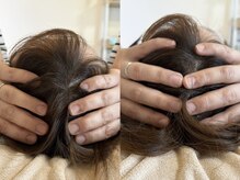 ジョワ 北堀江(joie)/美脳小顔矯正で頭もリフレッシュ